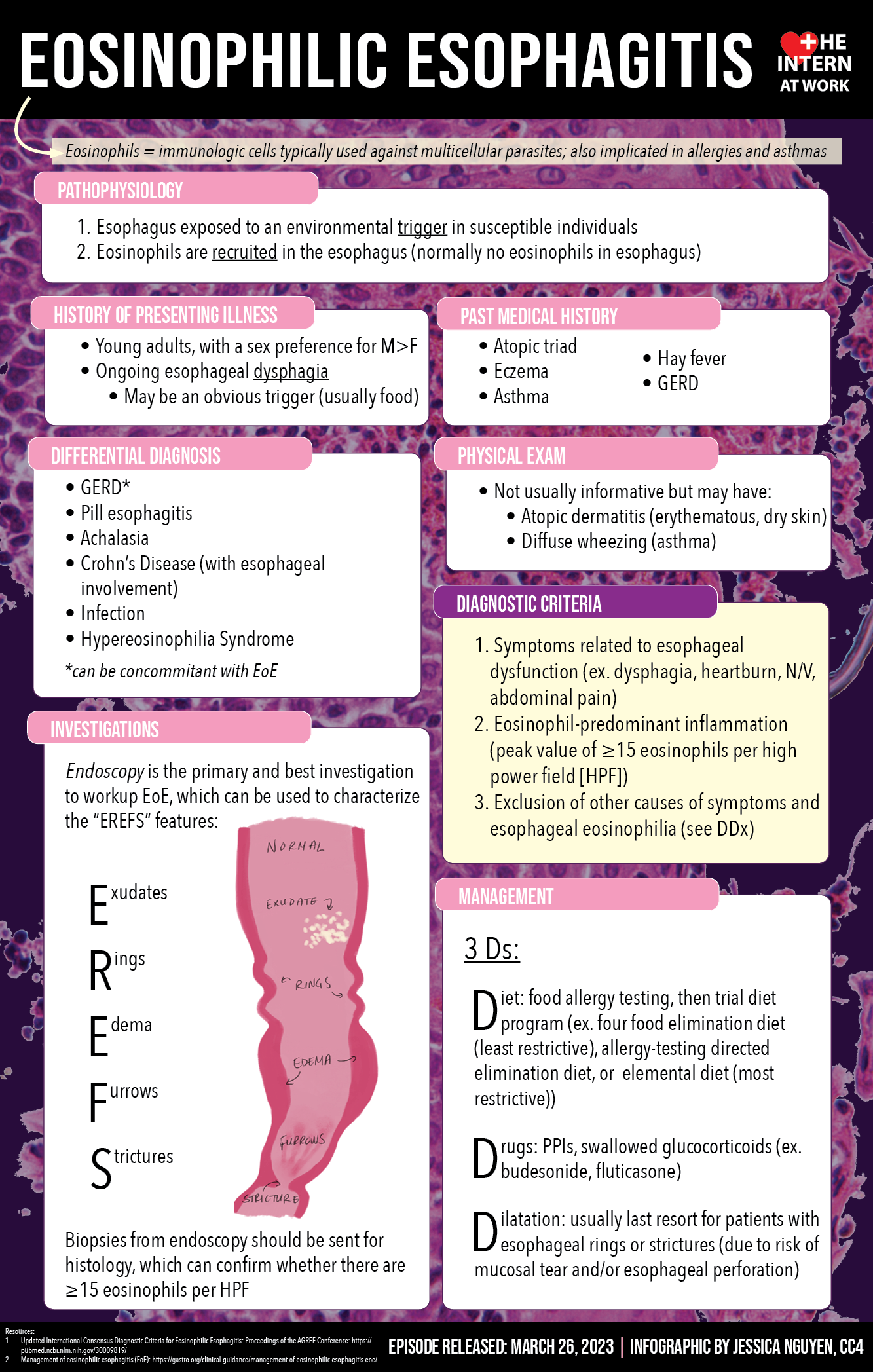 Eosinophilic Esophagitis - Medicine Pods