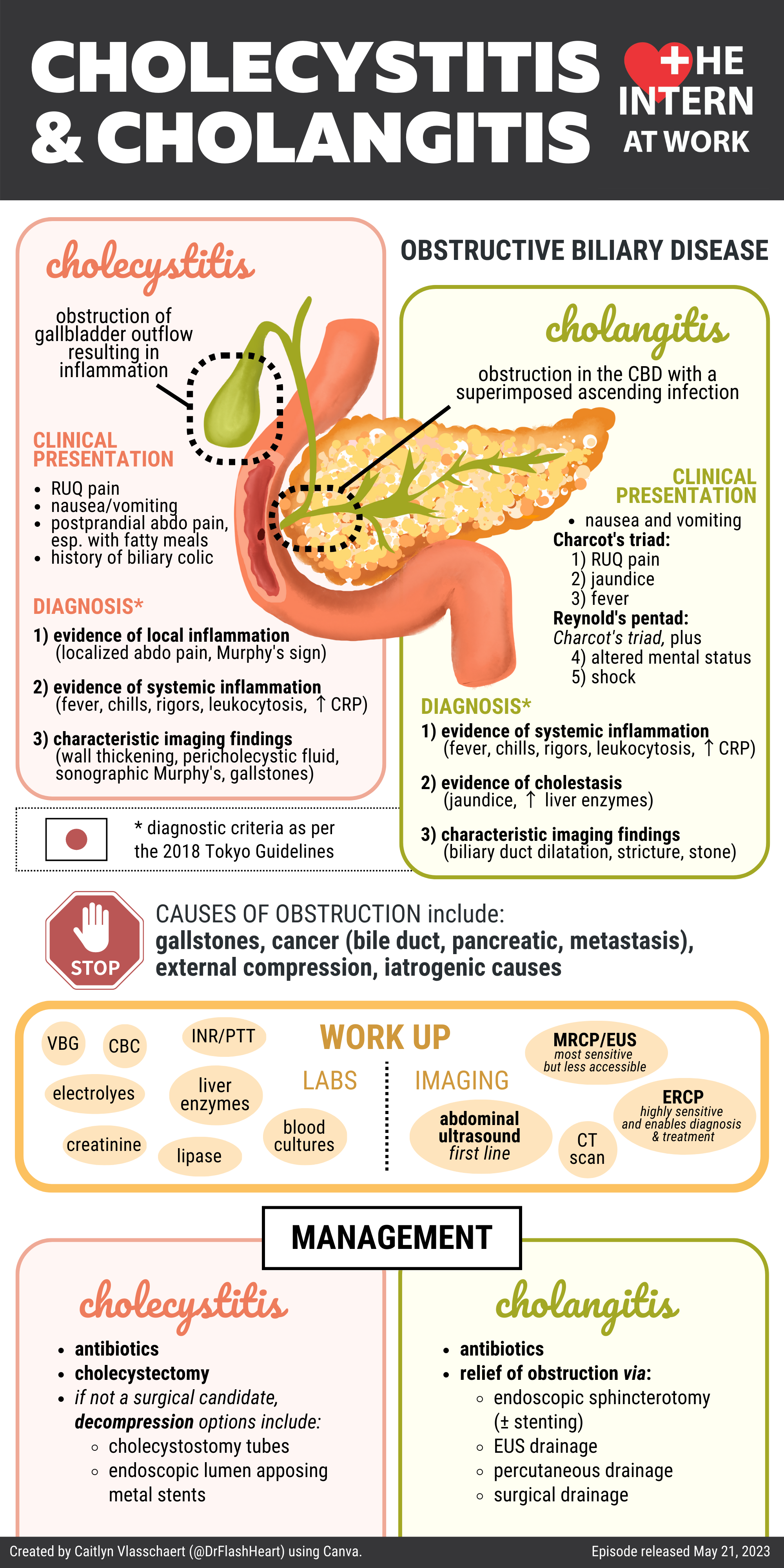 Cholecystitis and Cholangitis - Medicine Pods