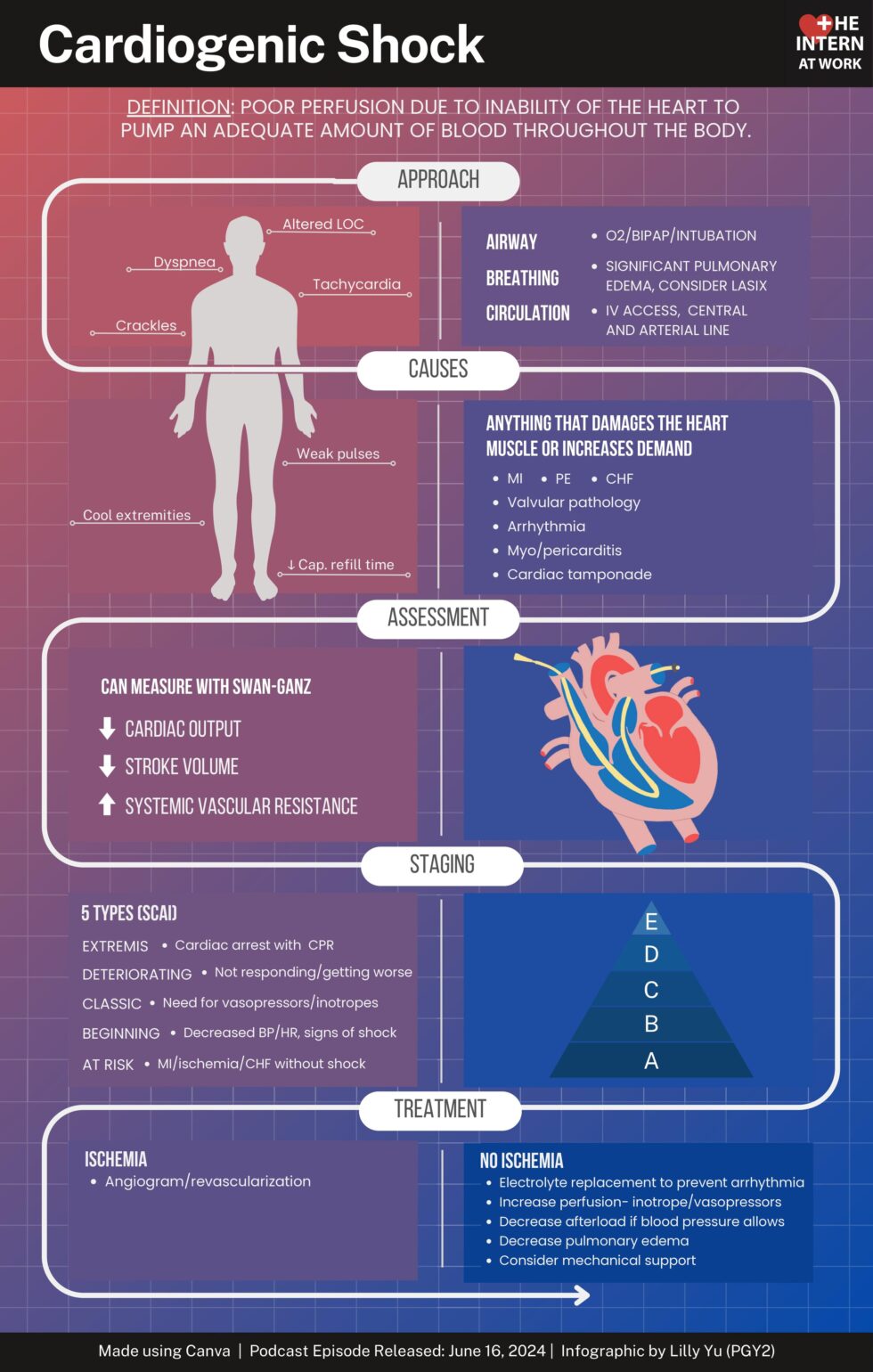 Cardiogenic Shock Medicine Pods