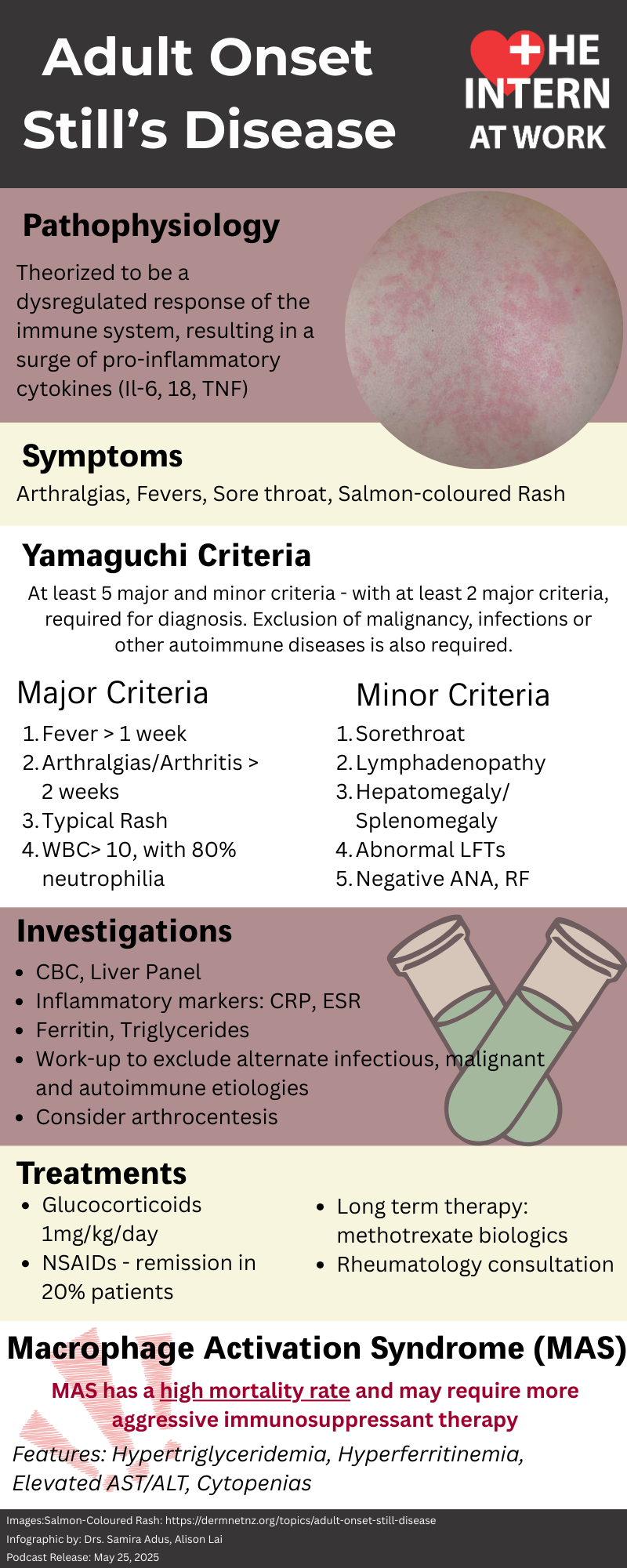 Adult Onset Still’s Disease