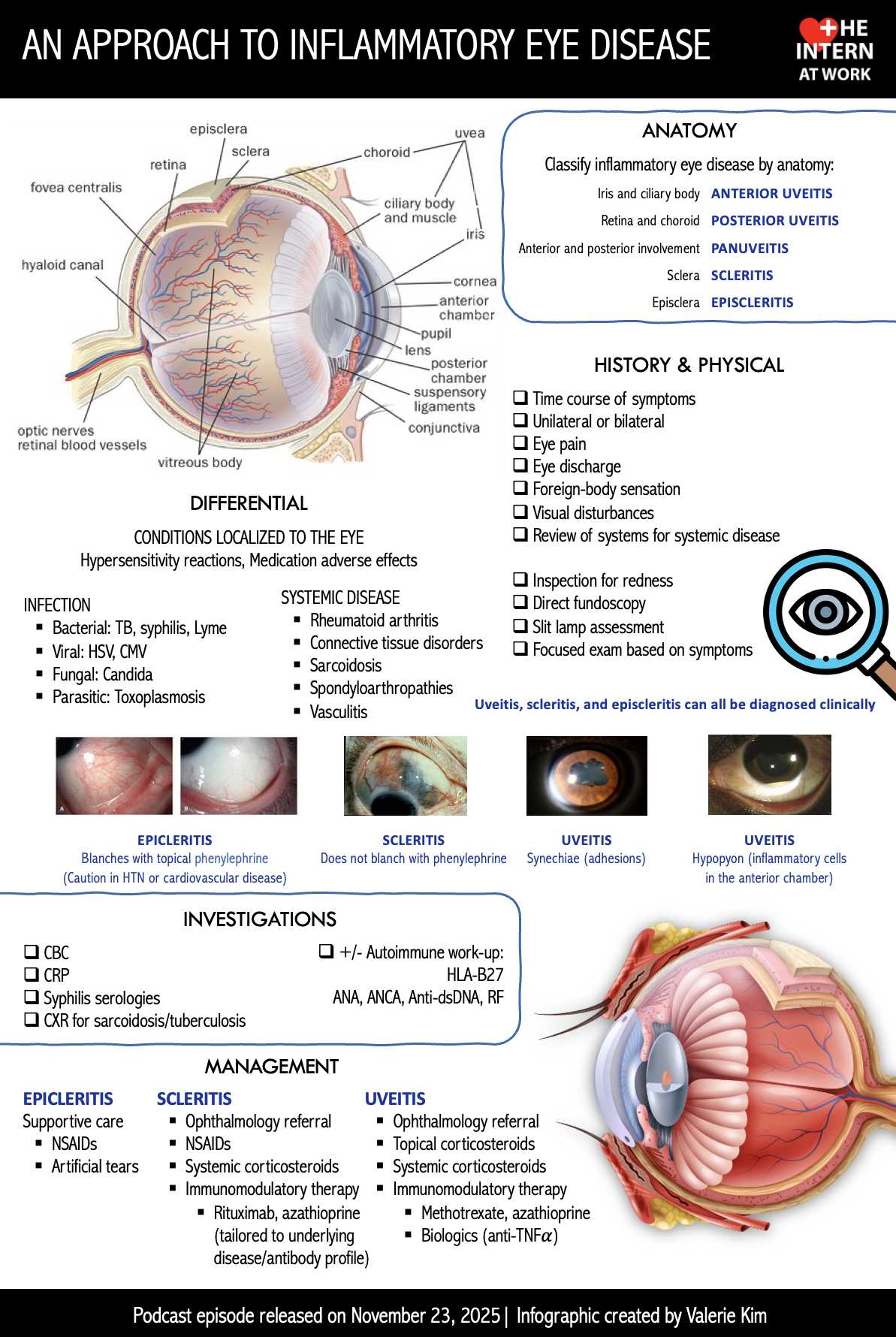 Inflammatory Eye Disease