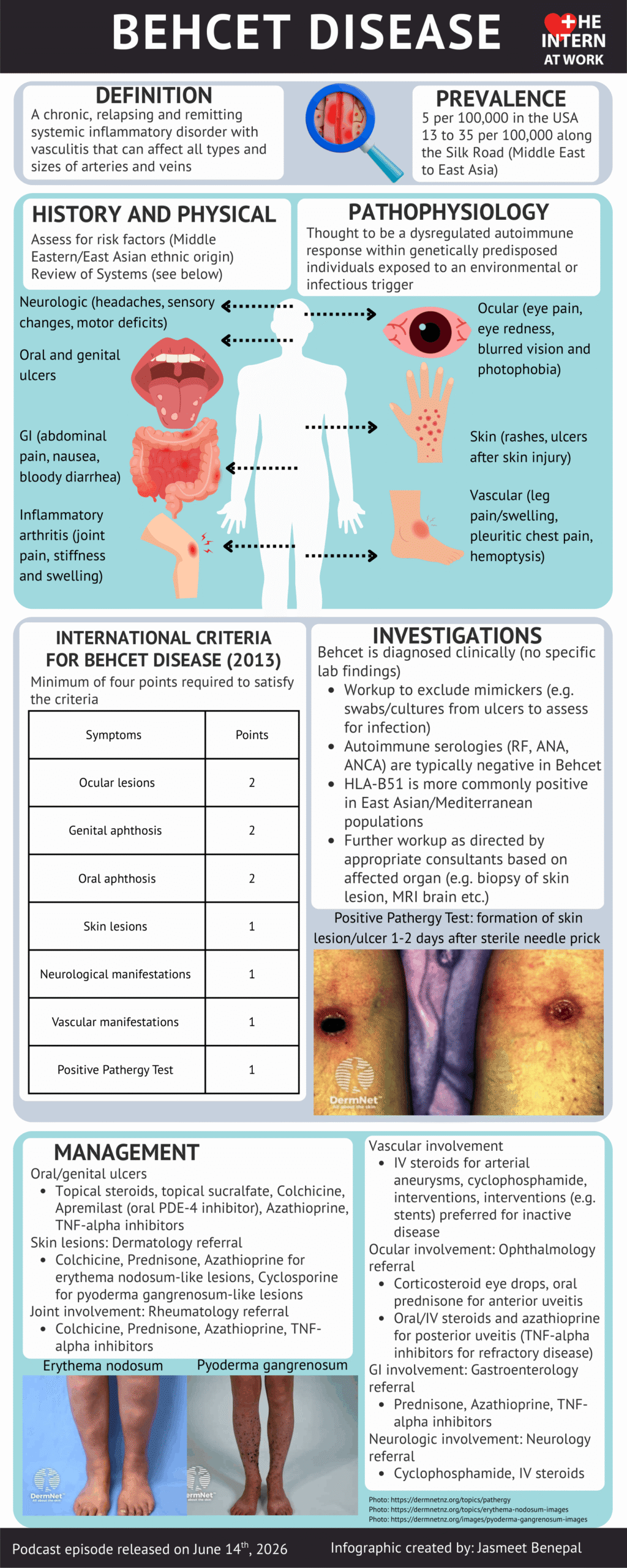 Behcet’s Disease
